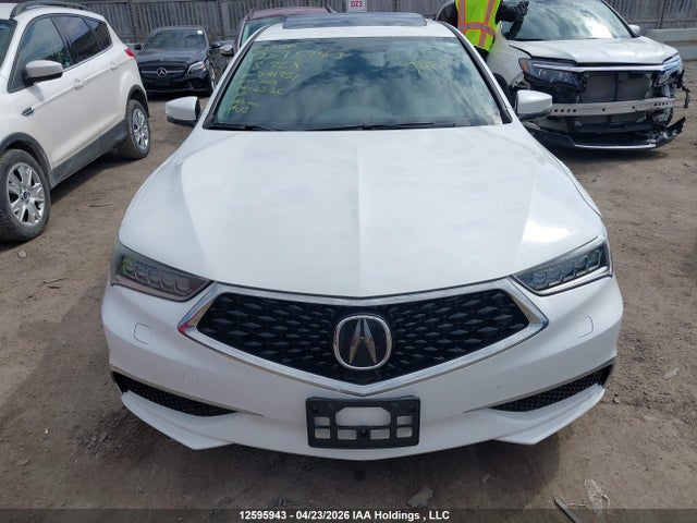 19UUB3F56JA801951 Acura TLX TECH