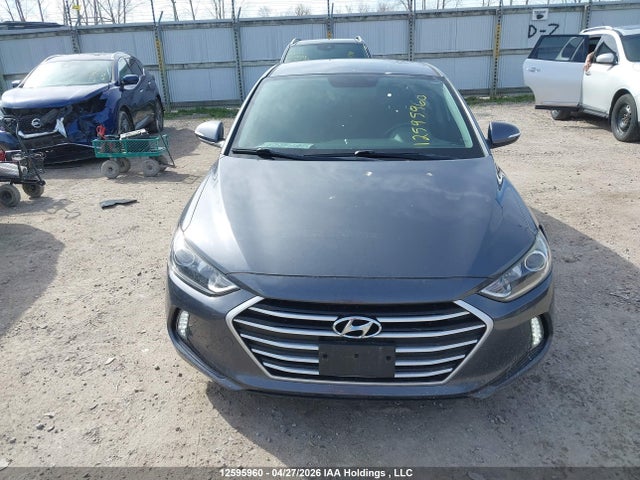 KMHD84LF3HU113183 Hyundai ELANTRA GL