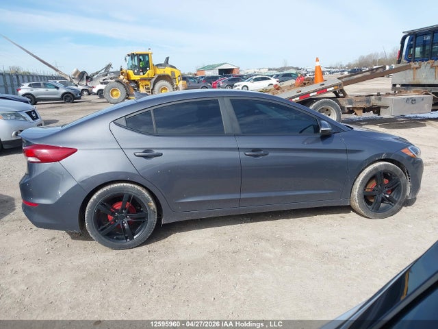 KMHD84LF3HU113183 Hyundai ELANTRA GL