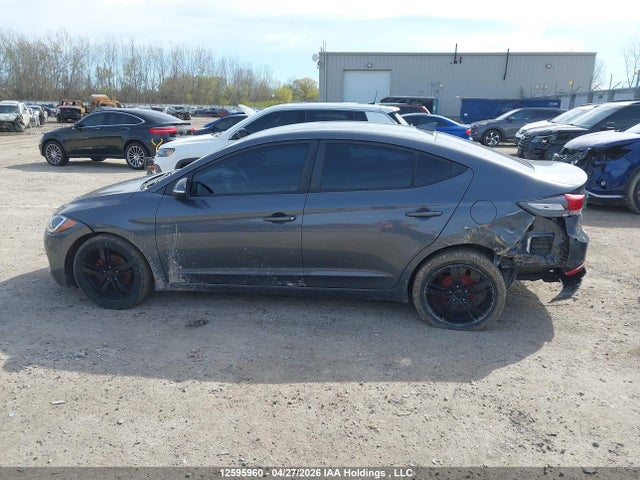 KMHD84LF3HU113183 Hyundai ELANTRA GL