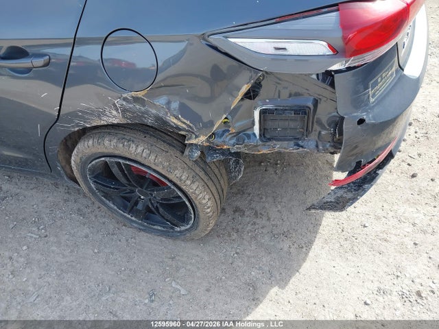KMHD84LF3HU113183 Hyundai ELANTRA GL