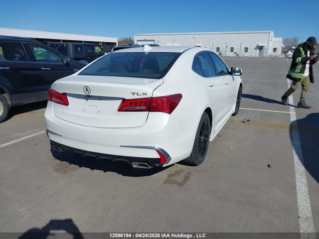 19UUB1F59JA800278 Acura TLX