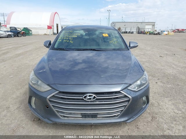 KMHD84LF6JU541156 Hyundai Elantra Gls