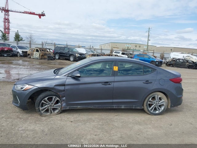 KMHD84LF6JU541156 Hyundai Elantra Gls