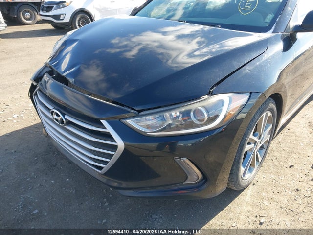 KMHD84LF6HU169070 Hyundai Elantra Gls