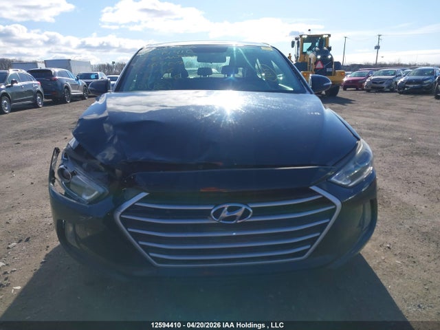 KMHD84LF6HU169070 Hyundai Elantra Gls