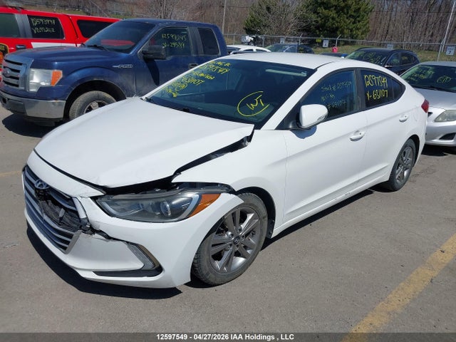 KMHD84LF5JU631107 Hyundai Elantra