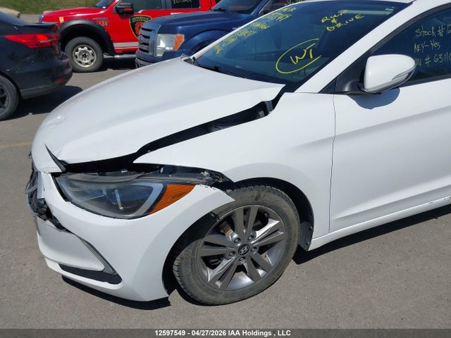 KMHD84LF5JU631107 Hyundai Elantra