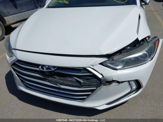 KMHD84LF5JU631107 Hyundai Elantra