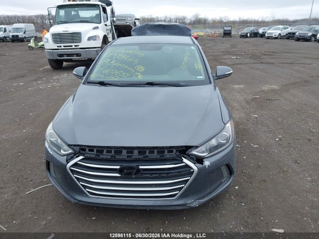 KMHD84LF7JU662634 Hyundai Elantra Sel/value/limited