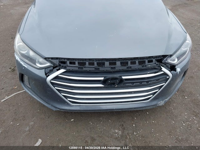 KMHD84LF7JU662634 Hyundai Elantra Sel/value/limited