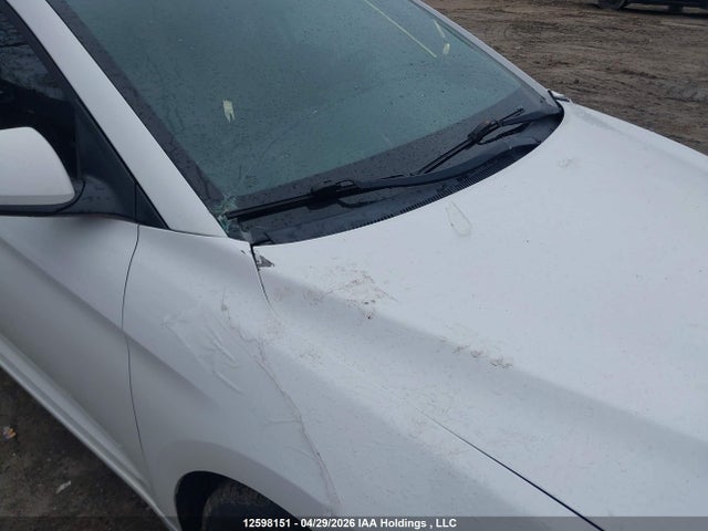 KMHD84LF7JU482814 Hyundai Elantra