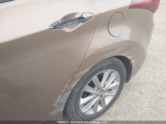 KMHDH4AE1GU551032 Hyundai Elantra Sport Appearance