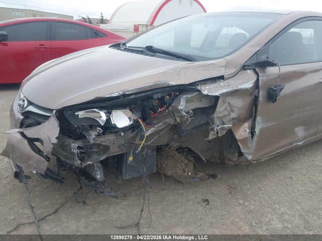 KMHDH4AE1GU551032 Hyundai Elantra Sport Appearance