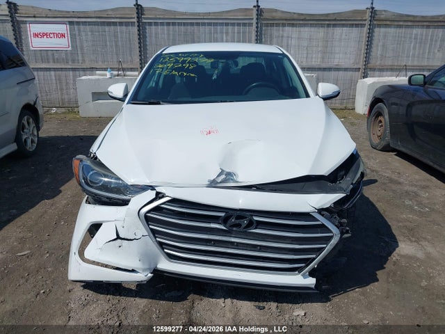 KMHD84LF5HU209798 Hyundai ELANTRA GL