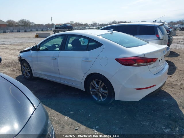 KMHD84LF5HU209798 Hyundai ELANTRA GL