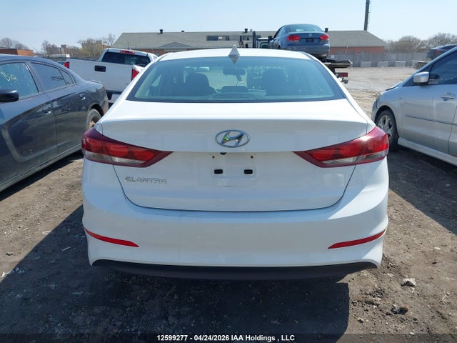 KMHD84LF5HU209798 Hyundai ELANTRA GL