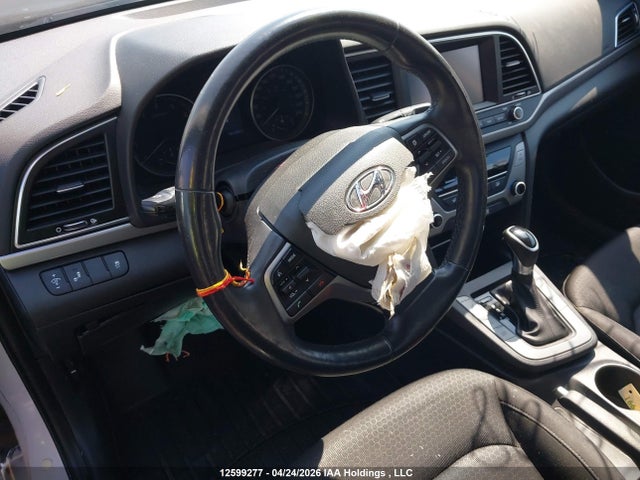 KMHD84LF5HU209798 Hyundai ELANTRA GL
