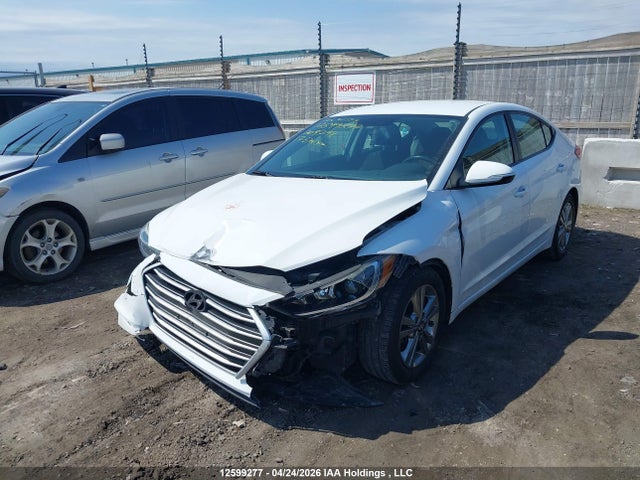 KMHD84LF5HU209798 Hyundai ELANTRA GL