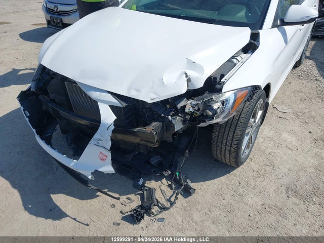 KMHD84LF9HU380344 Hyundai Elantra Gls