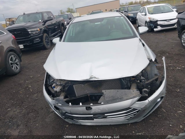 12599846 :رقم المزاد ، KMHD84LF0HU403350 vin ، 2017 Hyundai Elantra Se/value/limited مزاد بيع