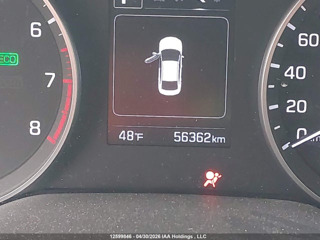 12599846 :رقم المزاد ، KMHD84LF0HU403350 vin ، 2017 Hyundai Elantra Se/value/limited مزاد بيع
