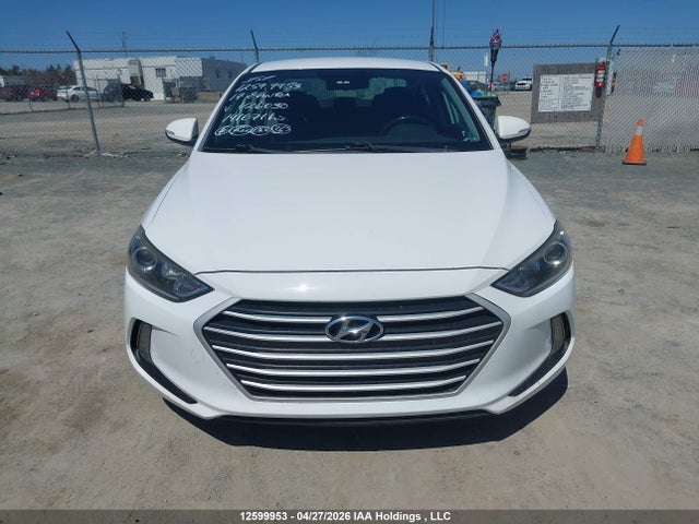 KMHD84LF9HU426030 Hyundai ELANTRA GL