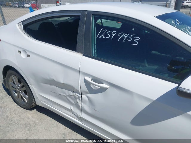 KMHD84LF9HU426030 Hyundai ELANTRA GL