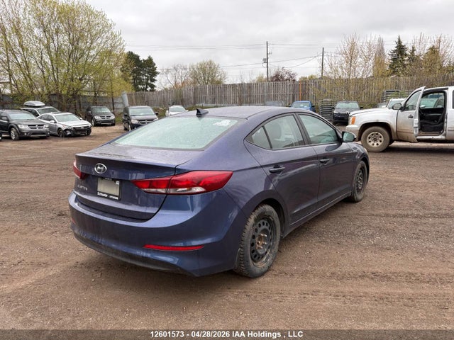KMHD84LF3JU552163 Hyundai Elantra Sel/value/limited