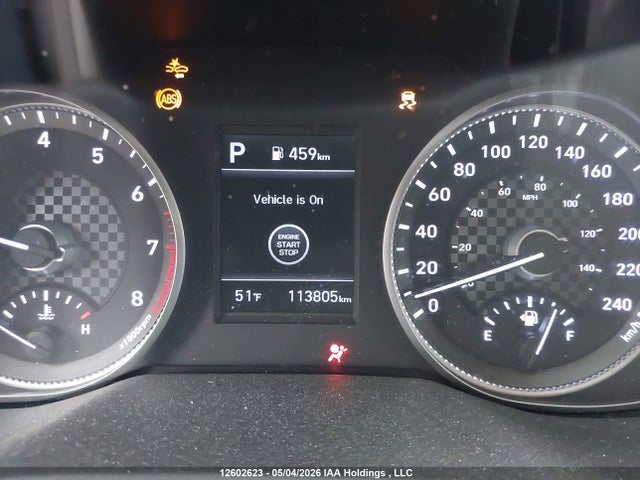 KMHD84LFXLU980329 Hyundai Elantra