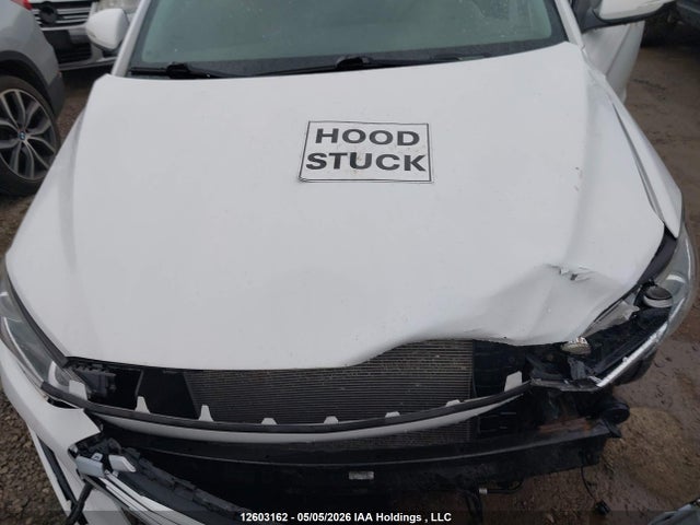 KMHD84LFXJU649862 Hyundai Elantra
