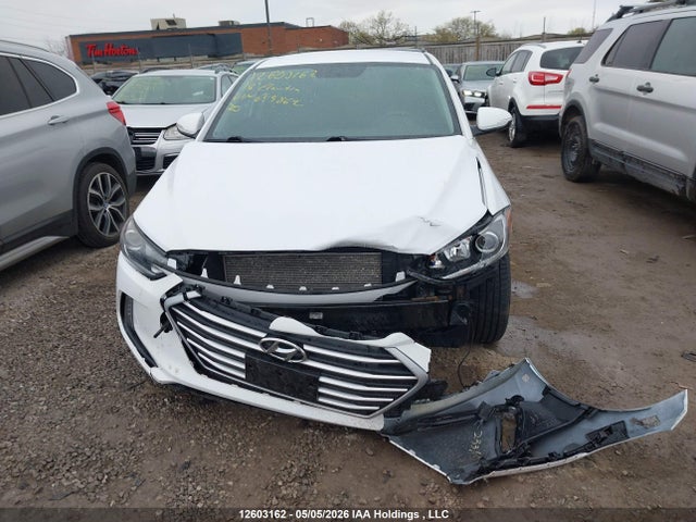 KMHD84LFXJU649862 Hyundai Elantra
