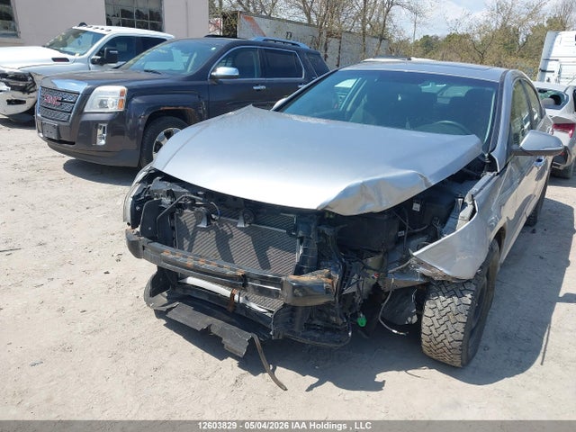 5NPE24AF6HH517313 Hyundai SONATA SE