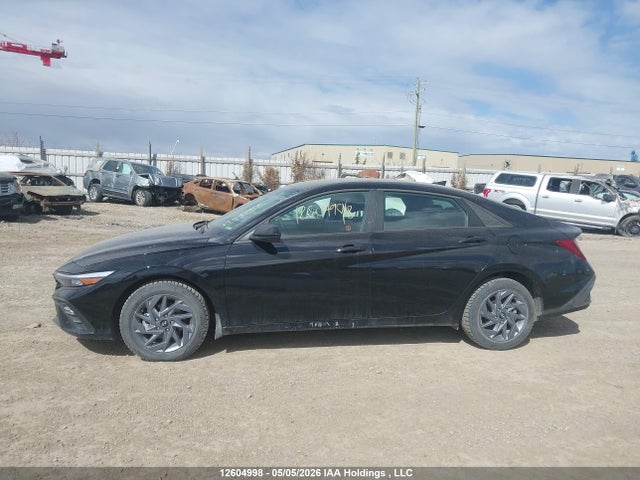 KMHLM4DG6RU667009 Hyundai ELANTRA SEL