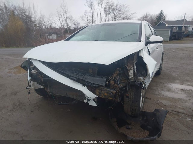 5NPE24AF6GH423527 Hyundai SONATA SE