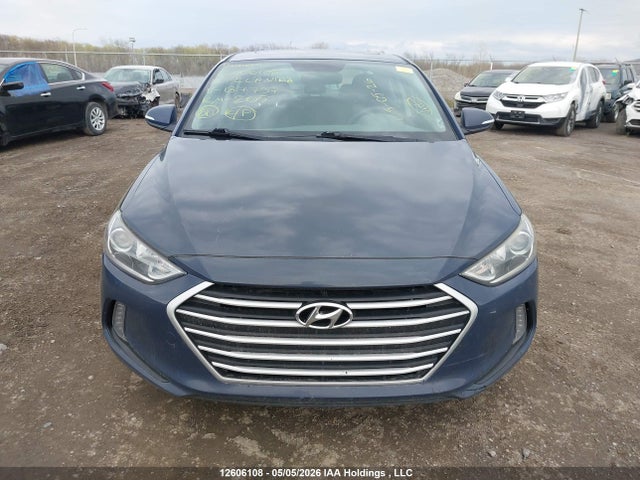 KMHD84LF5HU187737 Hyundai Elantra Gls