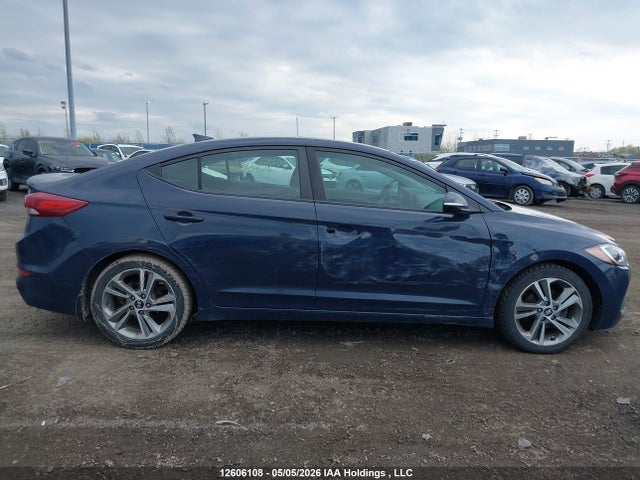 KMHD84LF5HU187737 Hyundai Elantra Gls