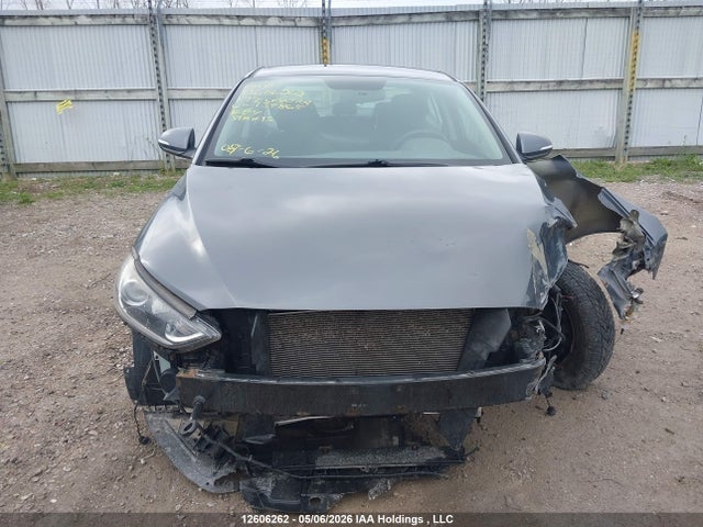 KMHD84LF5HU139865 Hyundai ELANTRA GL