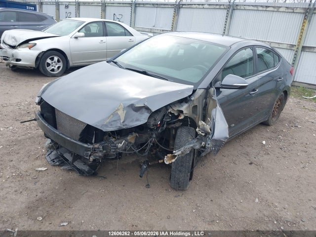 KMHD84LF5HU139865 Hyundai ELANTRA GL