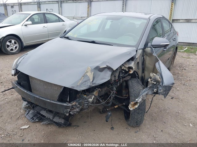 KMHD84LF5HU139865 Hyundai ELANTRA GL