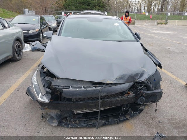 KMHD84LF7JU598255 Hyundai ELANTRA GL
