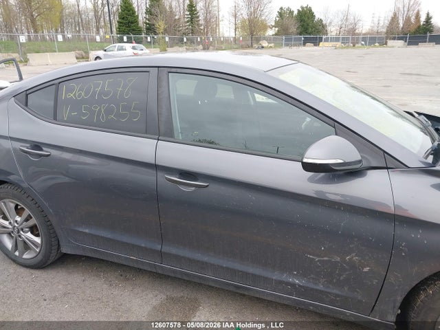 KMHD84LF7JU598255 Hyundai ELANTRA GL