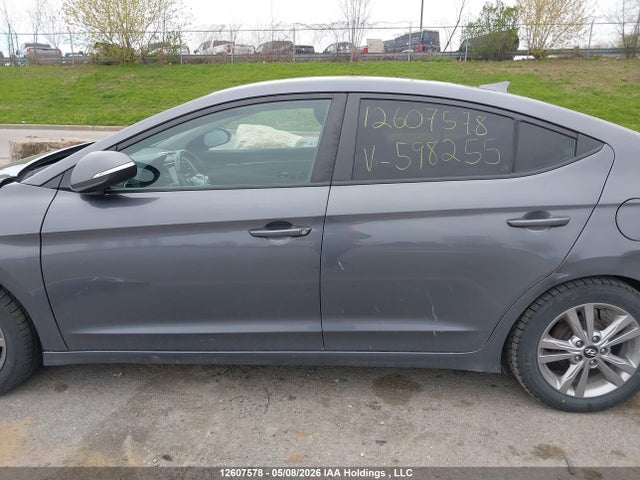 KMHD84LF7JU598255 Hyundai ELANTRA GL