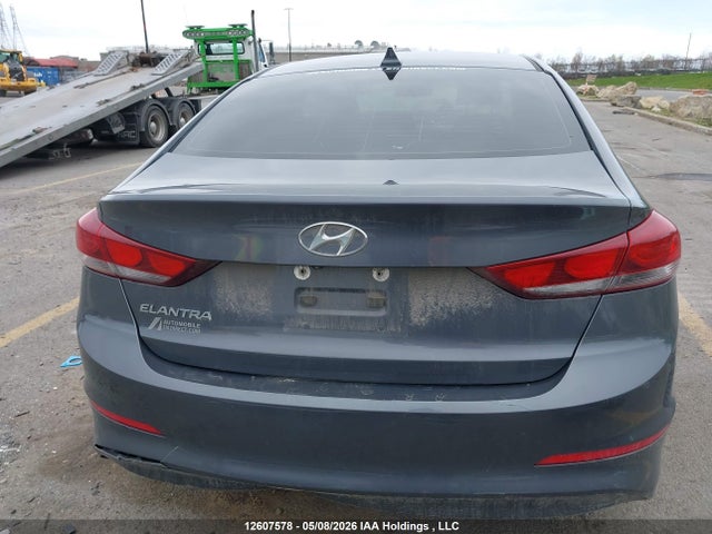 KMHD84LF7JU598255 Hyundai ELANTRA GL