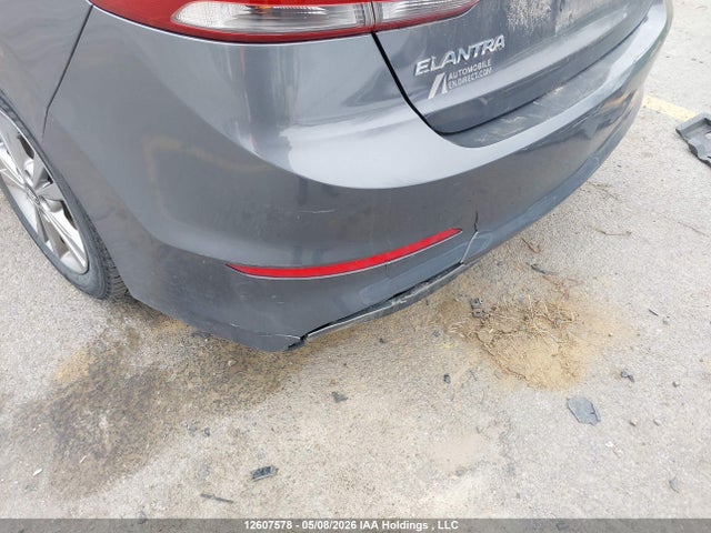 KMHD84LF7JU598255 Hyundai ELANTRA GL