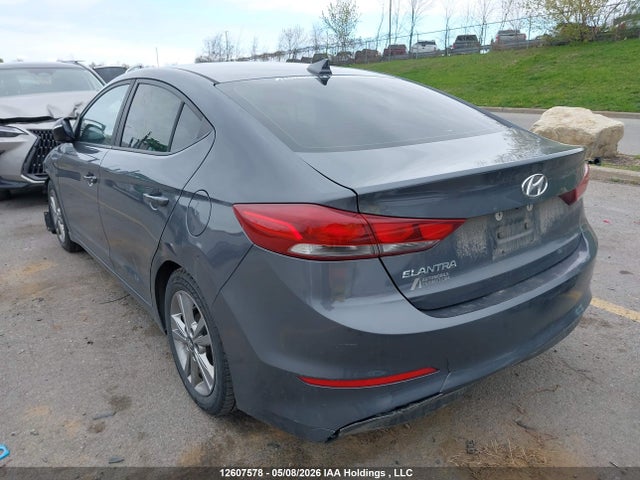 KMHD84LF7JU598255 Hyundai ELANTRA GL
