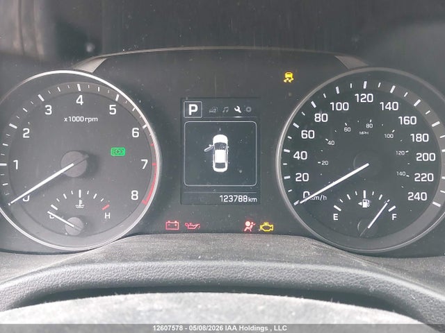 KMHD84LF7JU598255 Hyundai ELANTRA GL