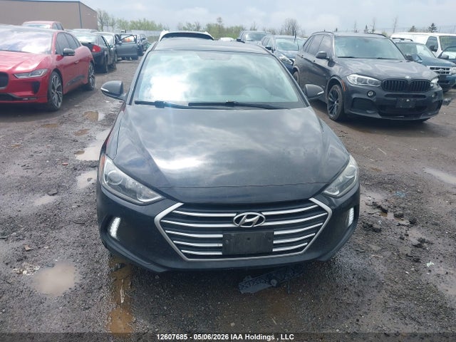 KMHD84LF5JU498428 Hyundai ELANTRA GL