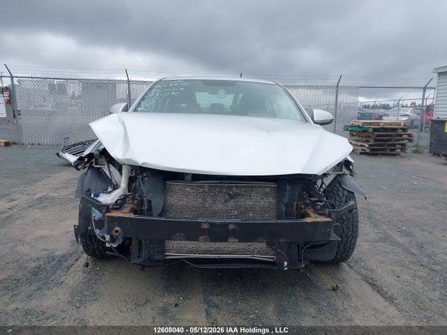 12608040 :رقم المزاد ، KMHD84LFXHU131292 vin ، 2017 Hyundai Elantra Se/value/limited مزاد بيع