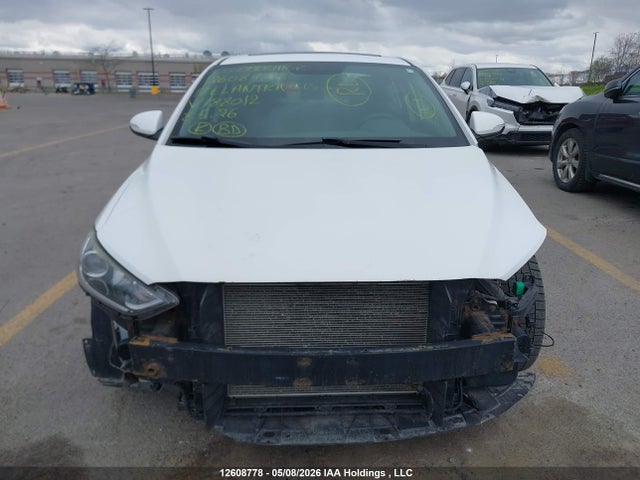 KMHD84LFXHU188012 Hyundai Elantra Gls